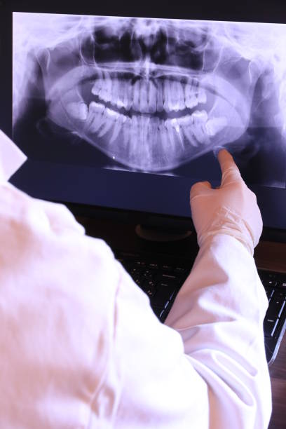 Best Broken or Cracked Tooth Emergency Dentist in Tucson Estates, AZ